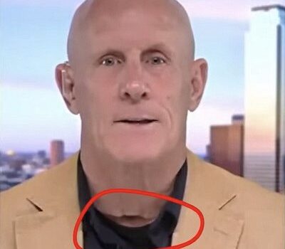 全米がビビる！FOXがゴム人間の露呈させた？